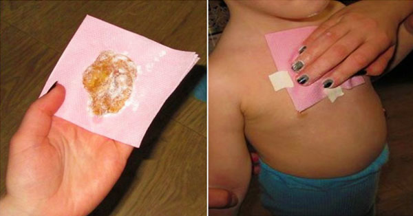 Wrapped Ginger – Cures Bad Cough And Removes Mucus From The Lungs in One Night!